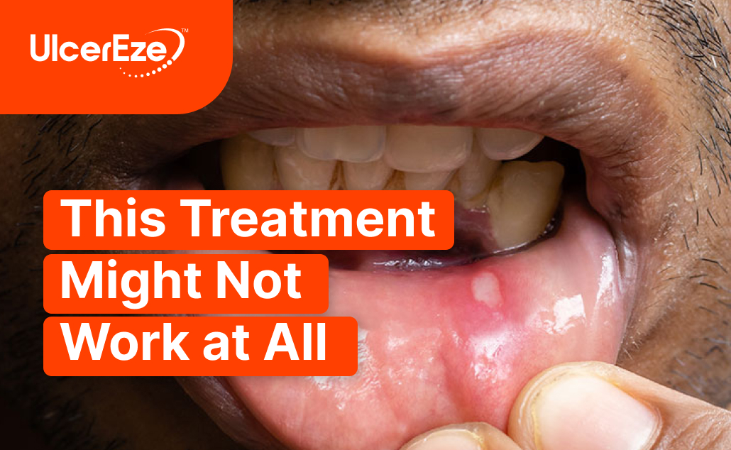 canker sore